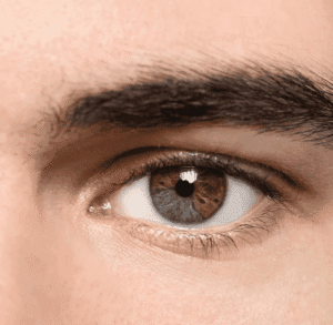 Homme avec hétérochromie, présentant deux couleurs différentes dans l'iris.